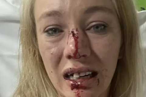 Jockey’s face smashed in with rock in horrific carjacking outside her house just three weeks before wedding