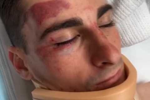 Rider's horror fall brings him closer to his partner